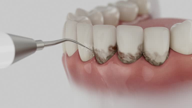Reliable Dental Implants contractor in Longmont, CO by Smile Center Dentistry